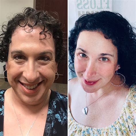 Almost 5 years HRT. 4 years since right before first FFS to 4 months