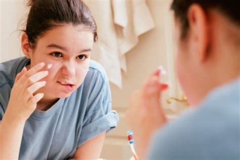 Средство от прыщей на лице для подростков: медикаменты и народные рецепты