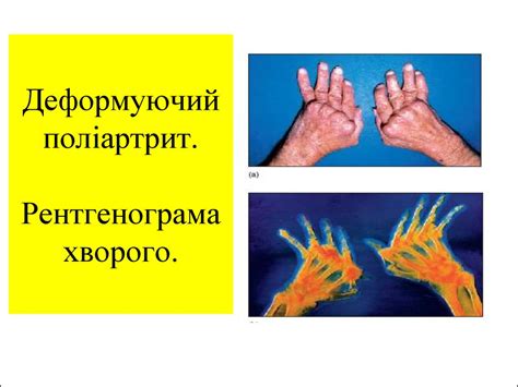 Вчення про з'єднання - презентация онлайн