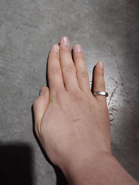 22 and twitching? : BFS