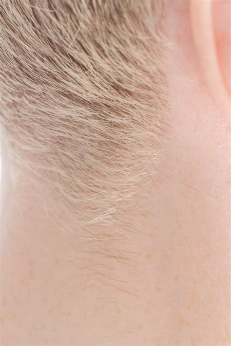 how to stop neck hair growth