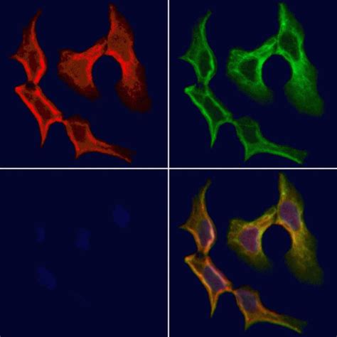 Tryptase Polyclonal Antibody (PA5-102552)