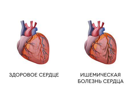 Здоровое Сердце Человека Фото — New-Freepik.Ru