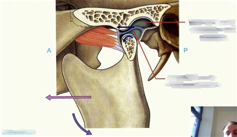 Diagram of Temporomandibular 3 | Quizlet