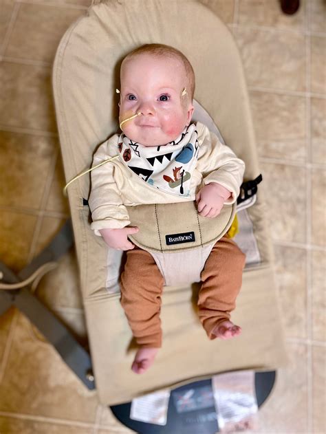 Cystic Hygroma & Turners syndrome | BabyCenter