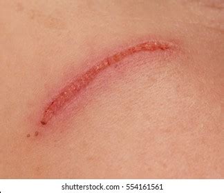 scratch  face stock photo  shutterstock