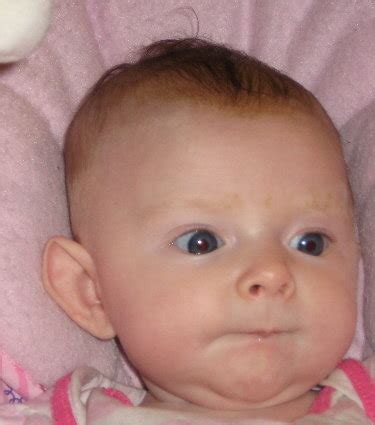 ugly babies  big ears  child big ears stock  high res