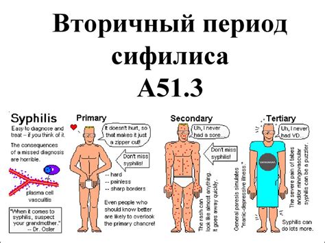 Вторичный период сифилиса - презентация онлайн
