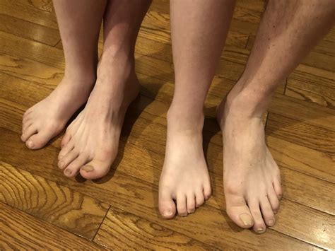 Healthy Feet