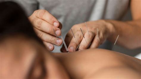 Acupunturista O Que É - Acupunturista: o que é, o que faz e quem pode atuar no Brasil
