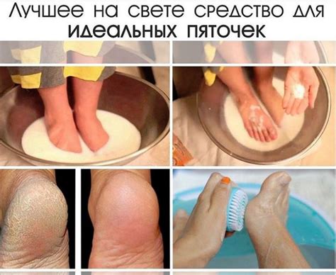 1. Ванночка для ног: сода 3 ч. л.; хозяйственное мыло (стружка) 1 ст. л ...