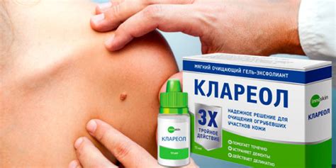 Для чего применяют Клареол Гель? - 500pokupok