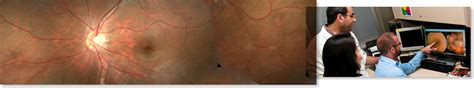 Eye Movement Disorders | Eye Conditions | Shiley Eye Institute | UC San Diego