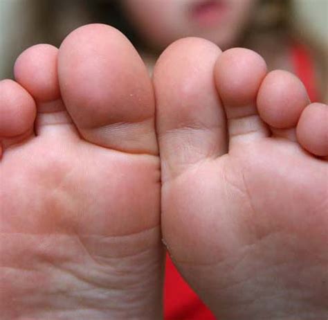 foot disorders