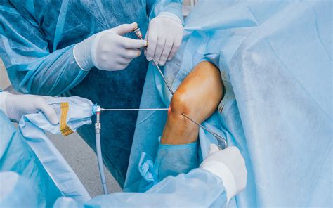 Knee Arthroscopy Conditions - Dr.S.Arumugam's Chennai Ortho