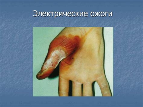 Электробезопасность. Действие электрического тока на человека - online ...