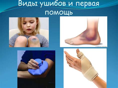 Первая помощь при ушибах и растяжениях, вывихах и переломах ...