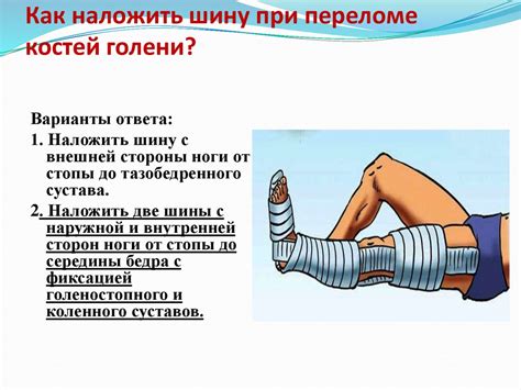 Первая помощь - презентация онлайн