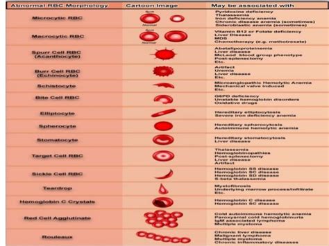 abnormal red blood cell morphologies vrogueco