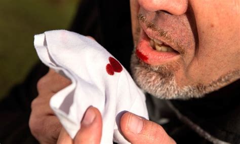 Coughing Blood - When You Need To See Doctor - Safar Medical