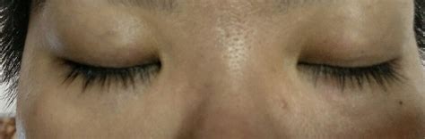 XLash review Result - Xlash Cosmetics Singapore