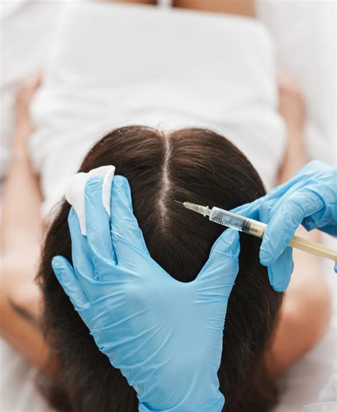PRP Therapy for Hair Restoration | Plasma Med Spa