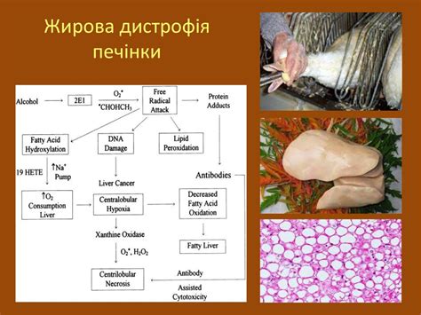 Патологія травлення та печінки - презентация онлайн