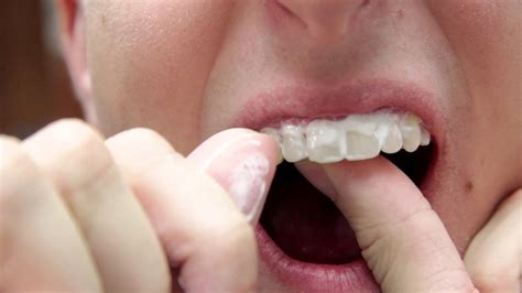 MI Paste Plus™ - Creekstone Dental