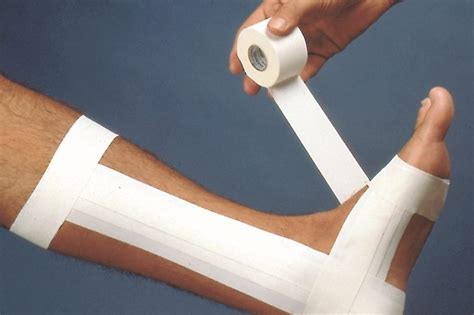 strap ankle kp therapy brandon hotel tralee kerry