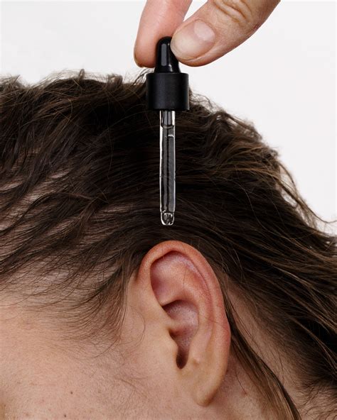 Blackheads In Ear Canal