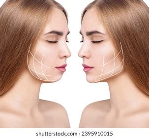 Woman Before After Cheekbones Shape Correction Stock Photo 2395910015 | Shutterstock