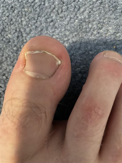 Countertop Cut Too Short at Andrew Godina blog