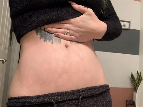 Weird permanent internal bruising?? (more deets in comments) : r