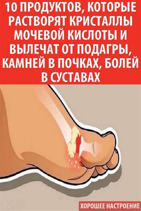 Эти мощные травы эффективно растворяют мочевую кислоту