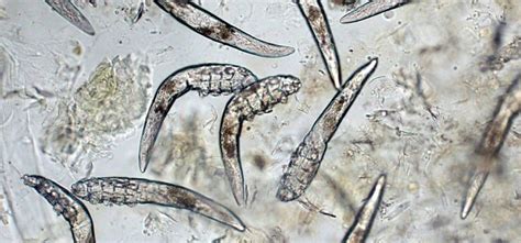 Demodex: o ácaro parasita que vive no seu rosto