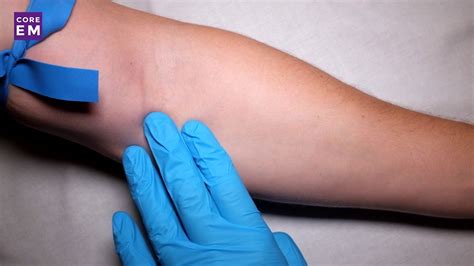 Starting a Peripheral IV Catheter - YouTube