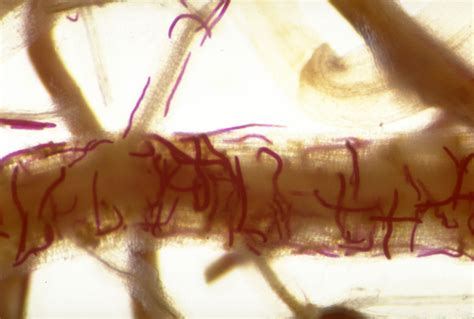 Parasitic Nematode - Barmac Pty Ltd