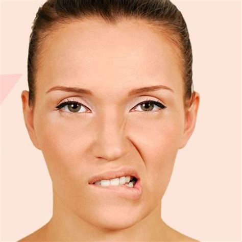 bells palsy face 7