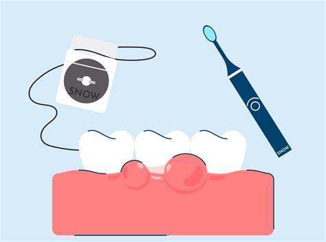 Swollen Gums: Causes, Treatment, and Prevention | SNOW® Oral Care