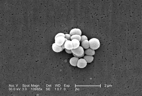 Free picture: ultrastructural, morphologic, features, group, gram ...