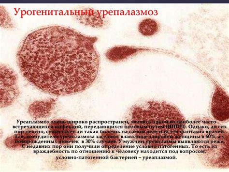 Урогенитальный уреаплазмоз - online presentation
