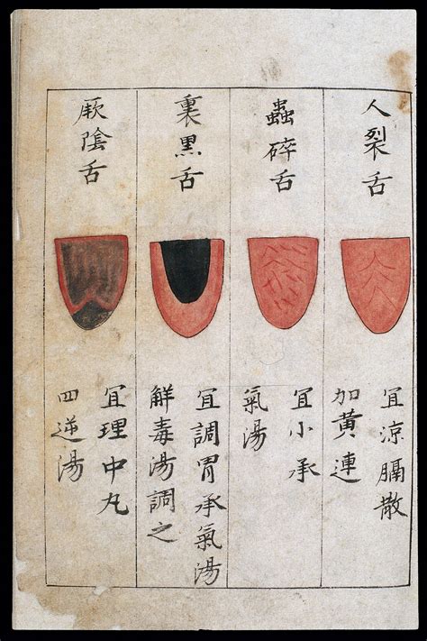 Traditional Chinese Medicine Tongue Diagnosis