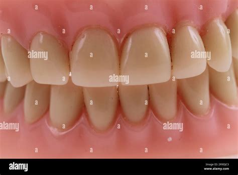 detail plastic teeth  nice dentist background stock photo alamy