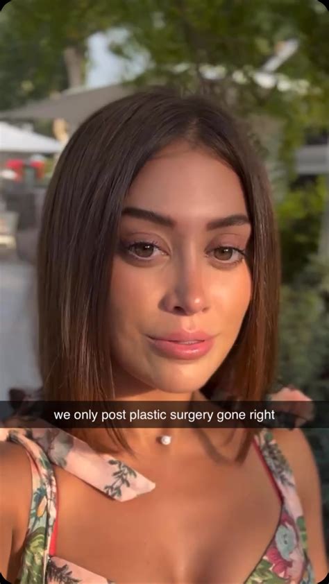 Hottest Women Celebrity's Shocking Transformation: Before & After! Image 2