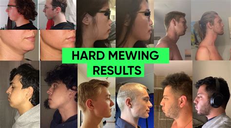 mewing mistakes   ruin  face mewingcoach