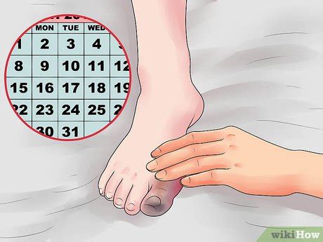 How to Prevent Gangrene (with Pictures) - wikiHow Health