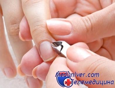 Обрезать или отодвигать кутикулу. Какой метод ухода за кутикулой ногтей ...