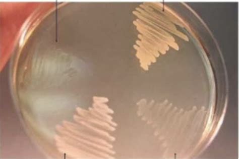 Lab one introduction to microbiology and Aseptic Transfer Flashcards ... 