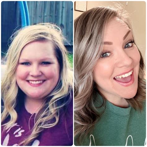 Tabby - Today officially marks ONE YEAR of being on a GLP-1… and I can