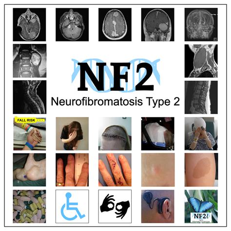 Neurofibromatosis Awareness